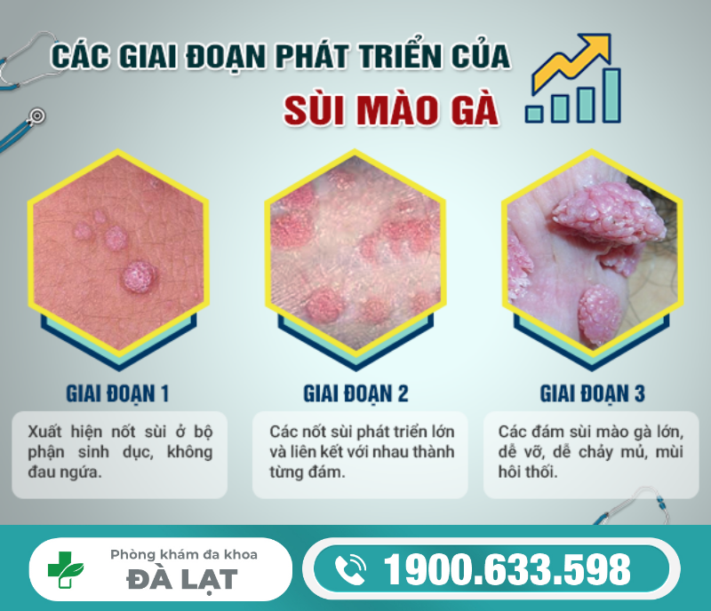 Hình ảnh minh họa